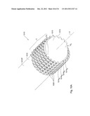 MULTI-EDGE CUTTING HEAD AND AN INSERT USED THEREIN diagram and image