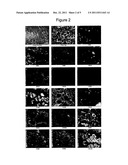 PHARMACEUTICAL COMPOSITION AND METHOD FOR IDENTIFYING A CANCEROUS AND/OR     AN INFLAMMATORY DISEASE IN A PATIENT diagram and image