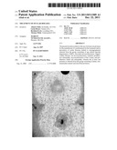 TREATMENT OF OCULAR DISEASES diagram and image