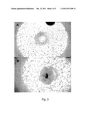 TREATMENT OF OCULAR DISEASES diagram and image