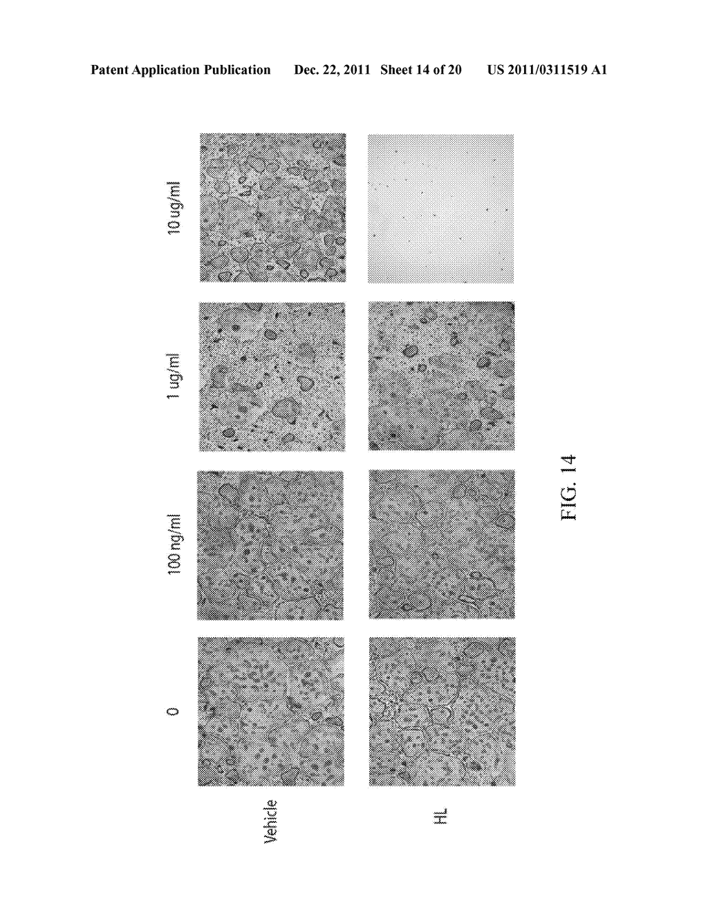 METHODS OF TREATMENT OF BONE DEGENERATIVE DISEASES - diagram, schematic, and image 15