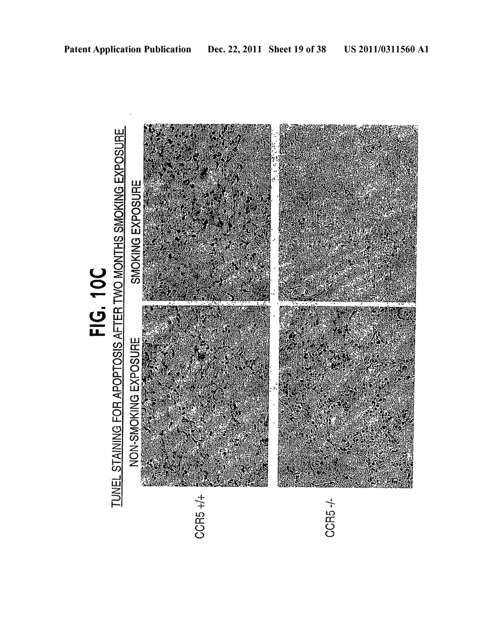 Methods and Compositions Relating to CCR5 Antagonist, IFN-Gamma and IL-13     Induced Inflammation - diagram, schematic, and image 20