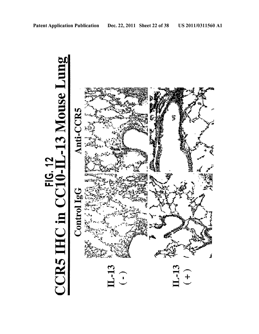 Methods and Compositions Relating to CCR5 Antagonist, IFN-Gamma and IL-13     Induced Inflammation - diagram, schematic, and image 23