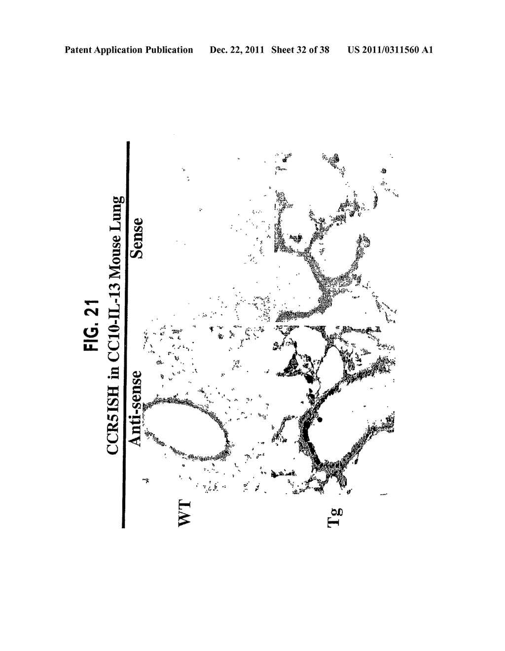 Methods and Compositions Relating to CCR5 Antagonist, IFN-Gamma and IL-13     Induced Inflammation - diagram, schematic, and image 33