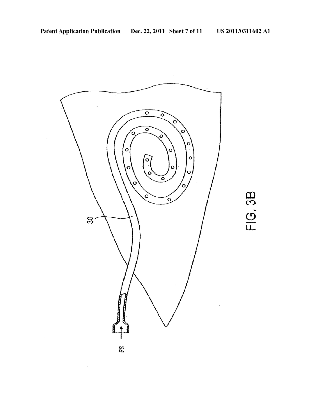 TRANSDERMAL VENOUS ACCESS LOCKING SOLUTIONS - diagram, schematic, and image 08