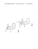 PUNCTAL PLUGS WITH CONTINUOUS OR PULSATILE DRUG RELEASE MECHANISM diagram and image