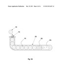 PUNCTAL PLUGS WITH CONTINUOUS OR PULSATILE DRUG RELEASE MECHANISM diagram and image