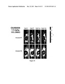 CARDENOLIDES FOR THE TREATMENT OF OCULAR CANCER diagram and image