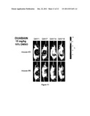 CARDENOLIDES FOR THE TREATMENT OF OCULAR CANCER diagram and image