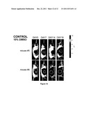 CARDENOLIDES FOR THE TREATMENT OF OCULAR CANCER diagram and image