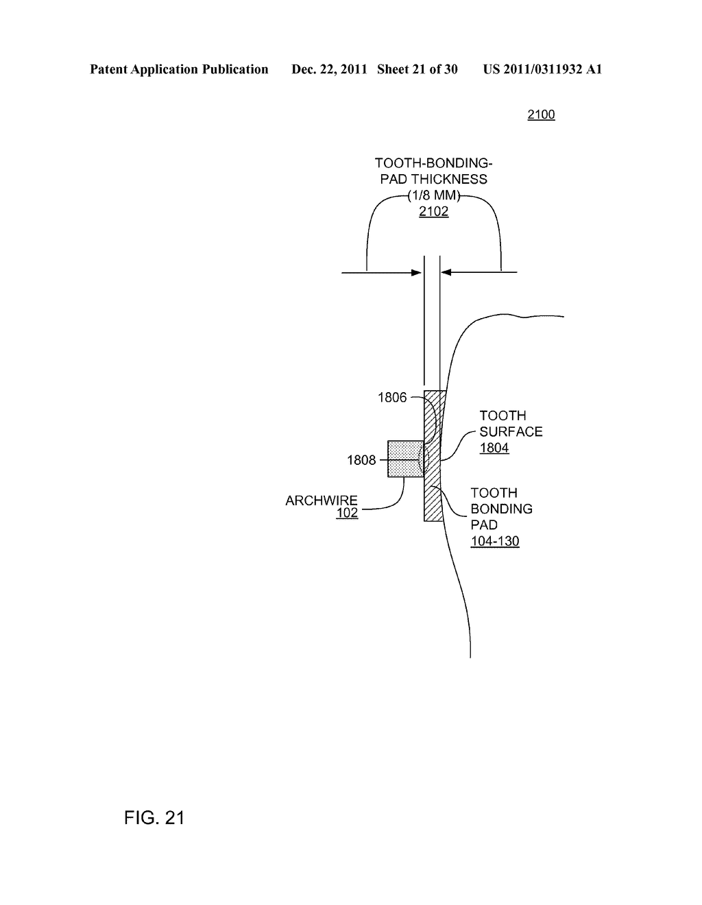 ORTHODONTIC DEVICE - diagram, schematic, and image 22