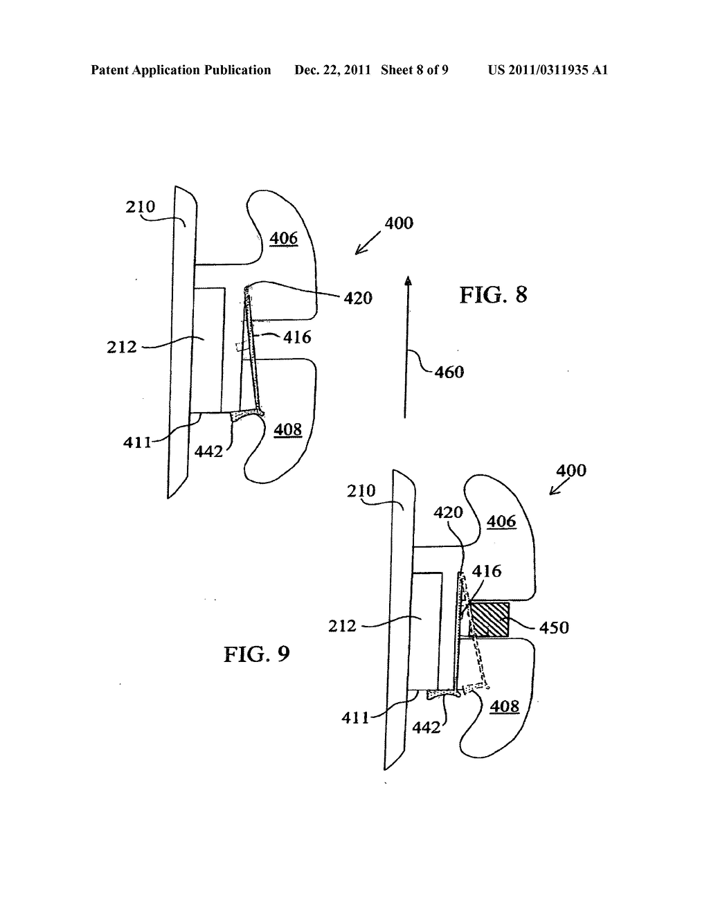 Orthodontic connector assembly and a method for treating teeth - diagram, schematic, and image 09