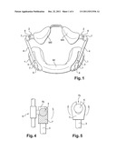 DEVICE FOR ARTICULATING AN ORTHODONTIC SYSTEM CAPABLE OF CAUSING THE     MOVEMENT OF A MANDIBLE IN RELATION TO A MAXILLA diagram and image