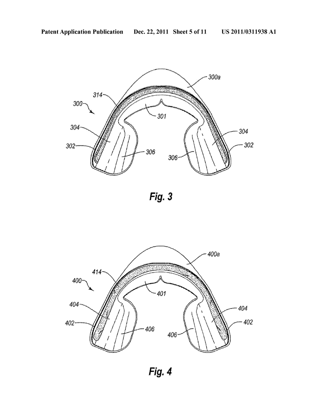 NON-CUSTOM DENTAL TREATMENT TRAYS HAVING IMPROVED ANATOMICAL FEATURES - diagram, schematic, and image 06