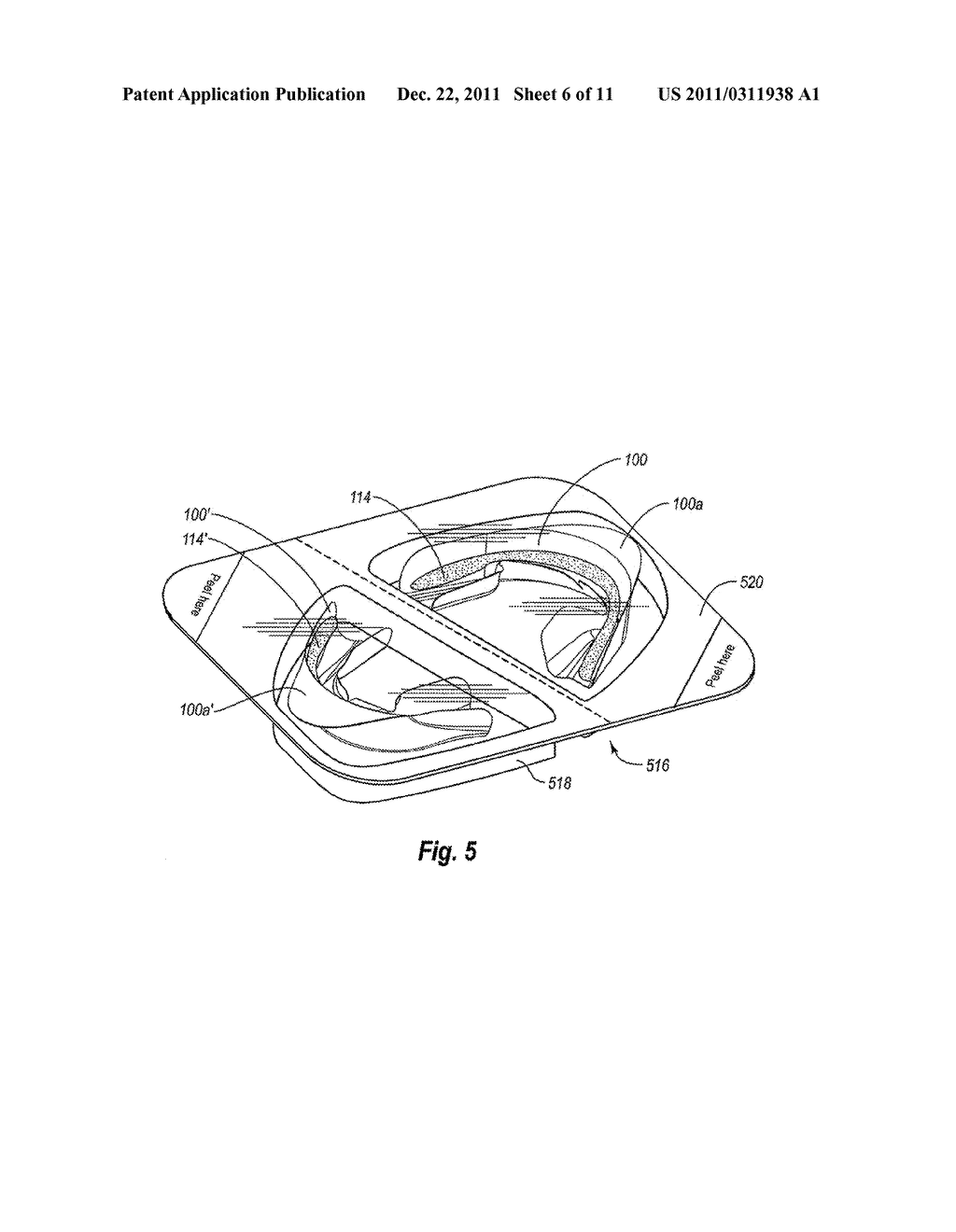 NON-CUSTOM DENTAL TREATMENT TRAYS HAVING IMPROVED ANATOMICAL FEATURES - diagram, schematic, and image 07