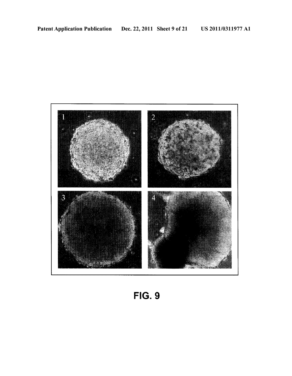 In Vitro Generation of Hepatocytes from Human Embryonic Stem Cells - diagram, schematic, and image 10