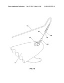 SURFBOARD LEASH SYSTEM AND METHOD diagram and image