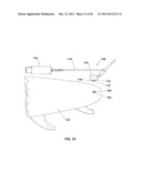 SURFBOARD LEASH SYSTEM AND METHOD diagram and image