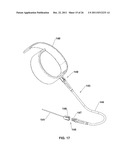 SURFBOARD LEASH SYSTEM AND METHOD diagram and image