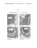 CYTOPROTECTIVE THEREAPEUTIC AGENTS FOR THE PREVENTION OF REPERFUSION     INJURY FOLLOWING ISCHEMIC STROKE diagram and image