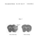 CYTOPROTECTIVE THEREAPEUTIC AGENTS FOR THE PREVENTION OF REPERFUSION     INJURY FOLLOWING ISCHEMIC STROKE diagram and image