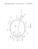 METHOD AND APPARATUS FOR LIMITING GROWTH OF EYE LENGTH diagram and image