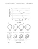 METHOD AND APPARATUS FOR LIMITING GROWTH OF EYE LENGTH diagram and image