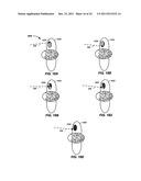 Multi-Field Charged Particle Cancer Therapy Method and Apparatus diagram and image