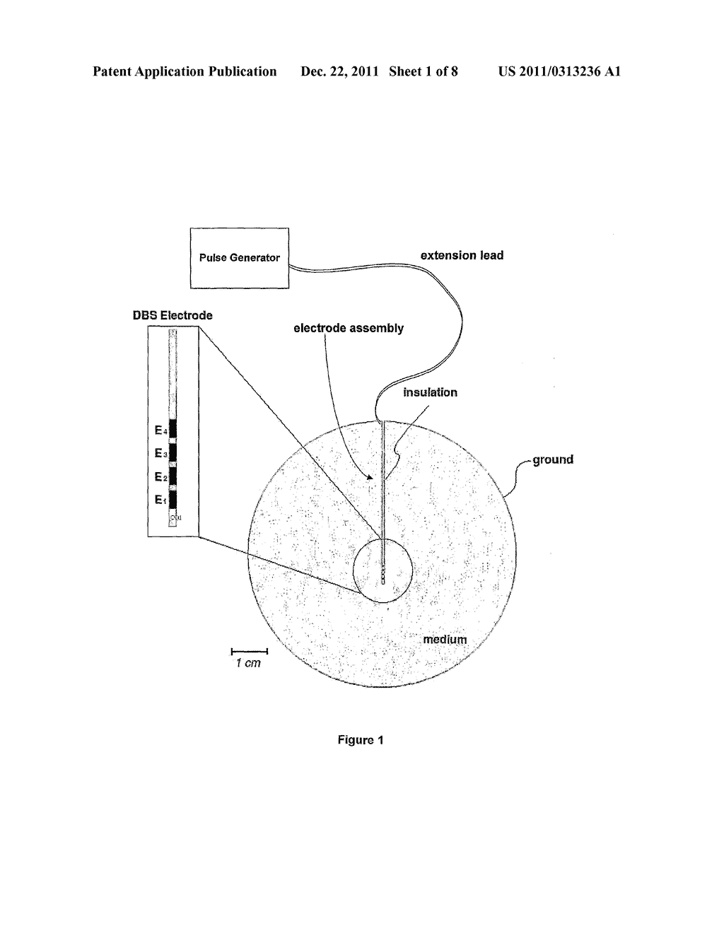 METHOD AND APPARATUS FOR PERFORMING DEEP BRAIN STIMULATION WITH AN     ELECTRIC FIELD - diagram, schematic, and image 02