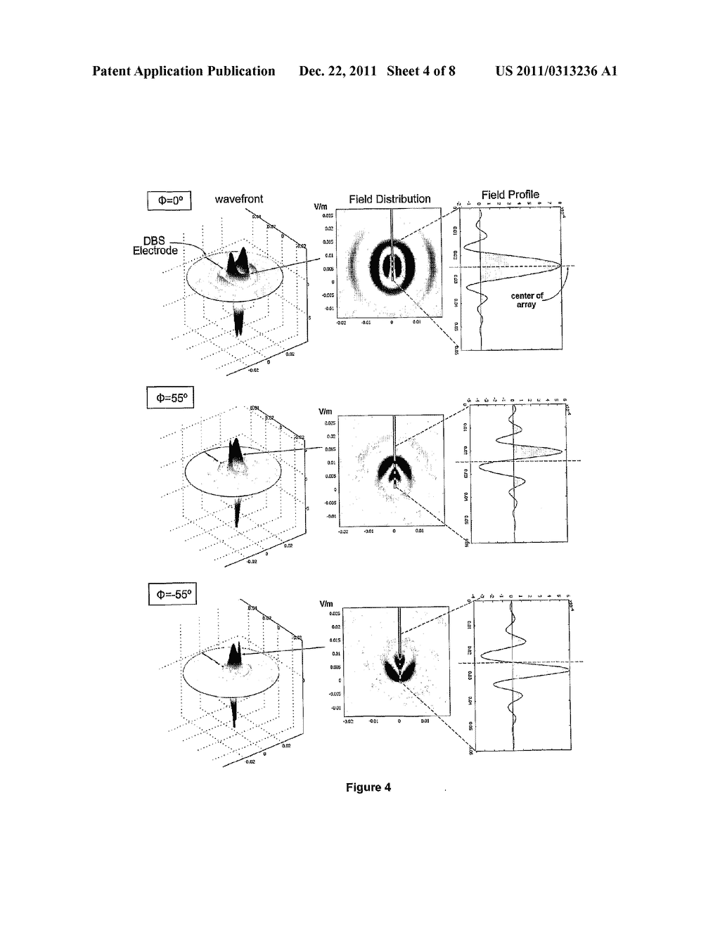 METHOD AND APPARATUS FOR PERFORMING DEEP BRAIN STIMULATION WITH AN     ELECTRIC FIELD - diagram, schematic, and image 05