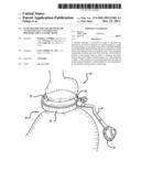 FLOW RESTRICTOR AND METHOD FOR AUTOMATICALLY CONTROLLING PRESSURE FOR A     GASTRIC BAND diagram and image