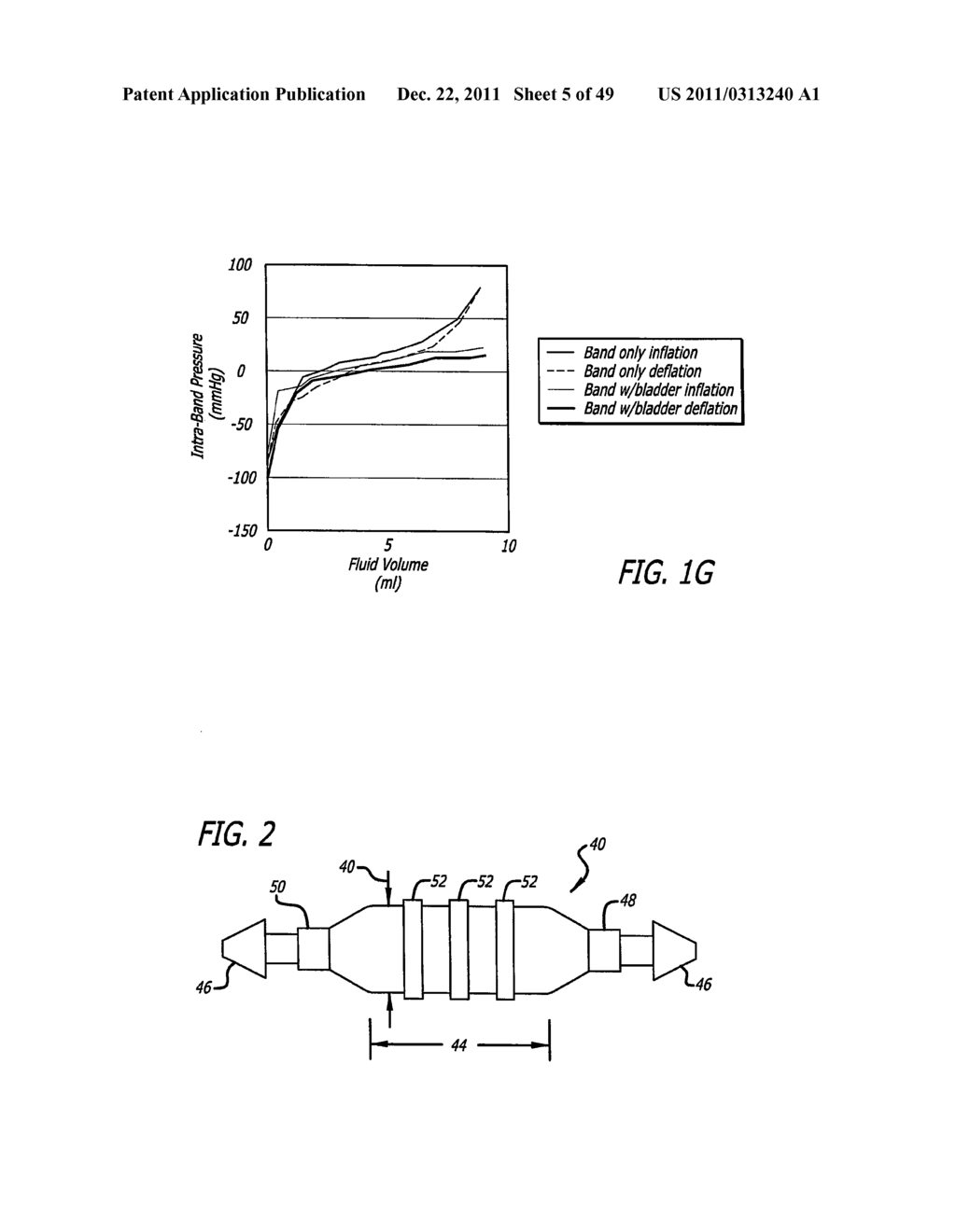 FLOW RESTRICTOR AND METHOD FOR AUTOMATICALLY CONTROLLING PRESSURE FOR A     GASTRIC BAND - diagram, schematic, and image 06