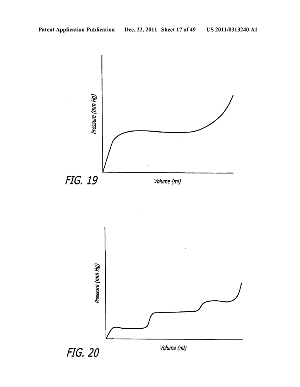 FLOW RESTRICTOR AND METHOD FOR AUTOMATICALLY CONTROLLING PRESSURE FOR A     GASTRIC BAND - diagram, schematic, and image 18