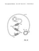 FLOW RESTRICTOR AND METHOD FOR AUTOMATICALLY CONTROLLING PRESSURE FOR A     GASTRIC BAND diagram and image