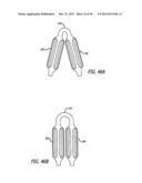 FLOW RESTRICTOR AND METHOD FOR AUTOMATICALLY CONTROLLING PRESSURE FOR A     GASTRIC BAND diagram and image