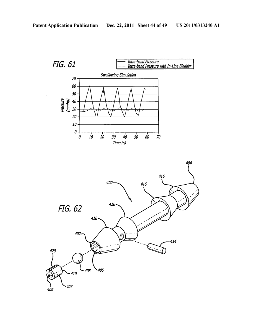 FLOW RESTRICTOR AND METHOD FOR AUTOMATICALLY CONTROLLING PRESSURE FOR A     GASTRIC BAND - diagram, schematic, and image 45