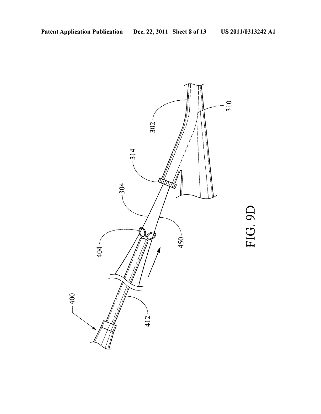 ENDOSCOPE SHEATH - diagram, schematic, and image 09