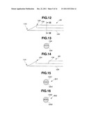 TREATMENT INSTRUMENT FOR ENDOSCOPE AND METHOD OF HARVESTING LYMPH NODE diagram and image