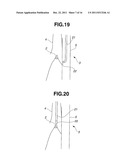 TREATMENT INSTRUMENT FOR ENDOSCOPE AND METHOD OF HARVESTING LYMPH NODE diagram and image