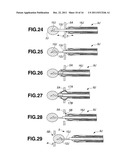 TREATMENT INSTRUMENT FOR ENDOSCOPE AND METHOD OF HARVESTING LYMPH NODE diagram and image