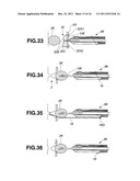 TREATMENT INSTRUMENT FOR ENDOSCOPE AND METHOD OF HARVESTING LYMPH NODE diagram and image