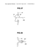 TREATMENT INSTRUMENT FOR ENDOSCOPE AND METHOD OF HARVESTING LYMPH NODE diagram and image