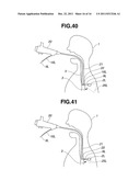 TREATMENT INSTRUMENT FOR ENDOSCOPE AND METHOD OF HARVESTING LYMPH NODE diagram and image