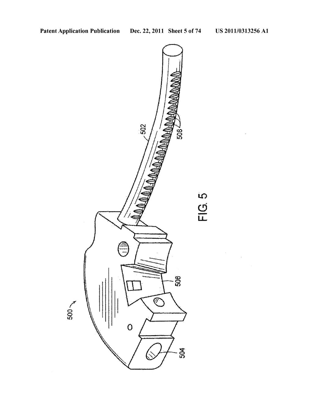 SURGICAL METHODS AND SURGICAL KITS - diagram, schematic, and image 06