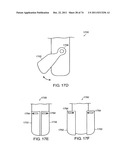 SURGICAL METHODS AND SURGICAL KITS diagram and image