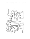 SURGICAL METHODS AND SURGICAL KITS diagram and image