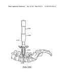 SURGICAL METHODS AND SURGICAL KITS diagram and image