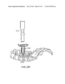 SURGICAL METHODS AND SURGICAL KITS diagram and image