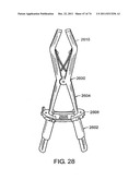 SURGICAL METHODS AND SURGICAL KITS diagram and image