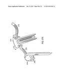 SURGICAL METHODS AND SURGICAL KITS diagram and image